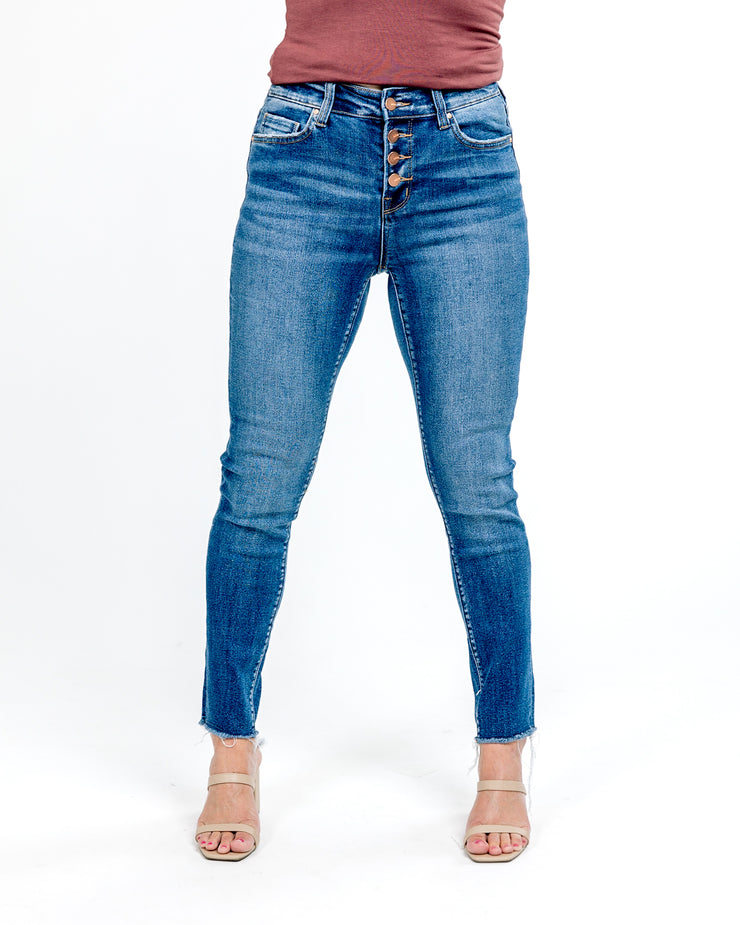 Statement Button Front Crop Skinny Jeans