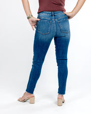 Statement Button Front Crop Skinny Jeans